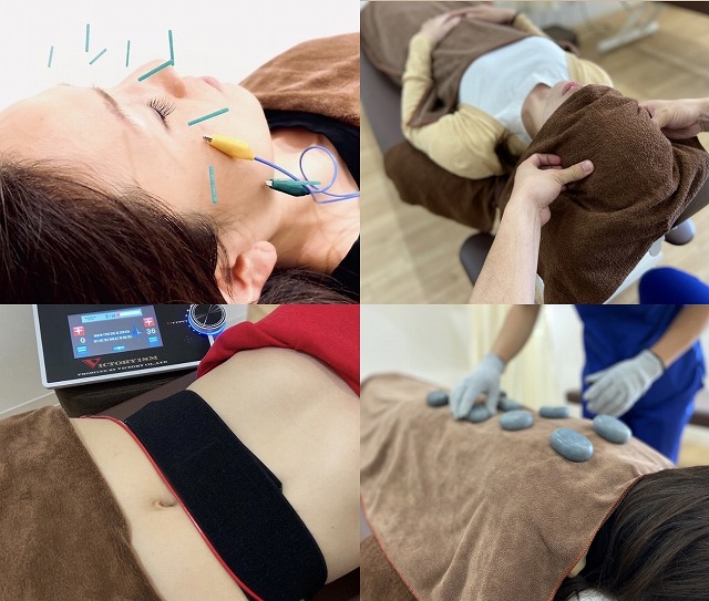 豊富な施術メニュー